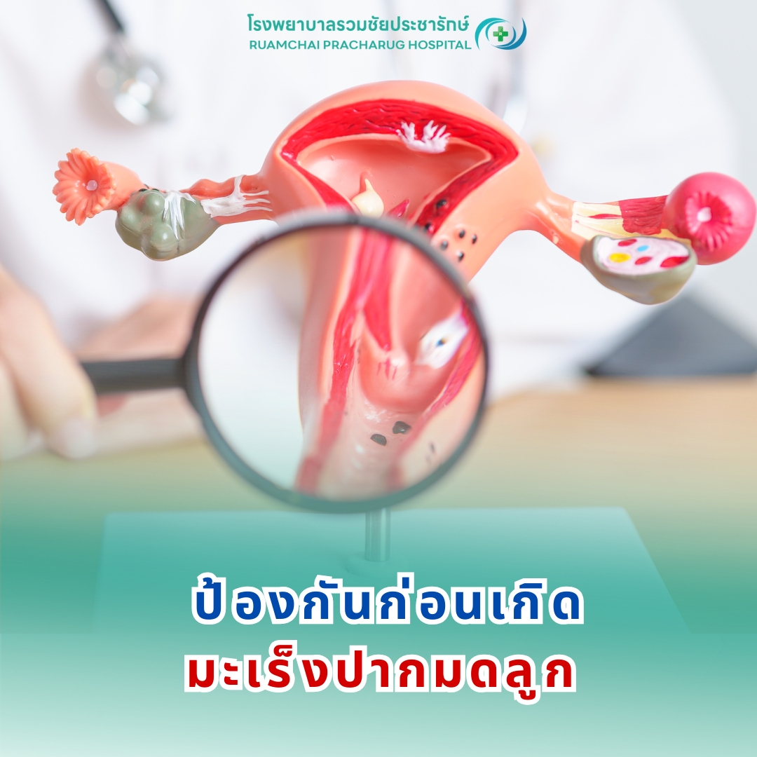 มะเร็งปากมดลูก